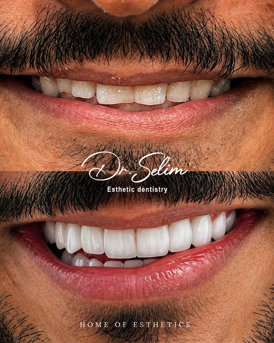 Case 1 - Before & After
